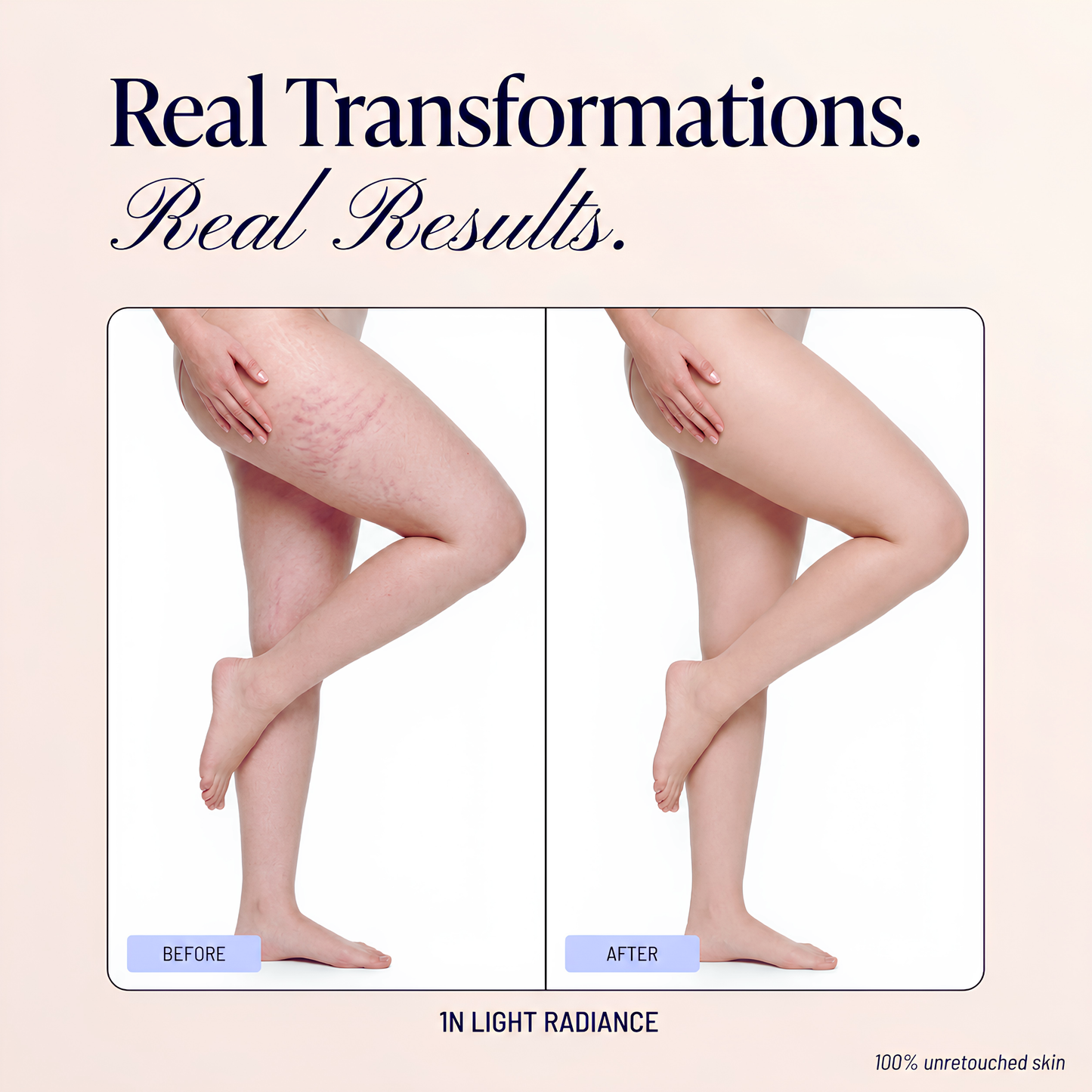 Body Coverage Perfector